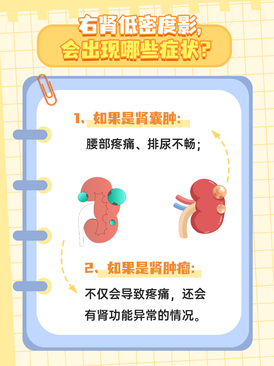 出现右肾低密度影？小心患上这些疾病！