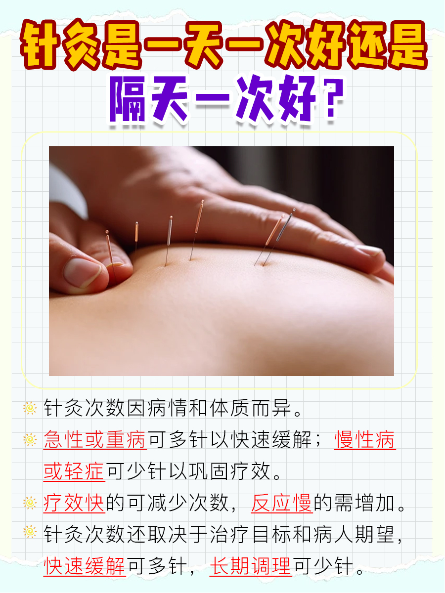 针灸频率选择：一天一次还是隔天一次？