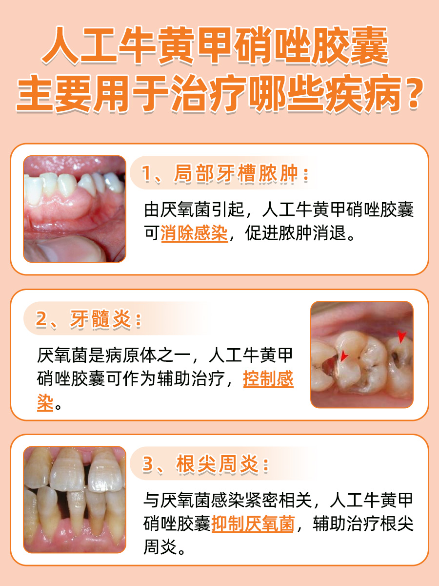 专业解读：人工牛黄甲硝唑胶囊的作用