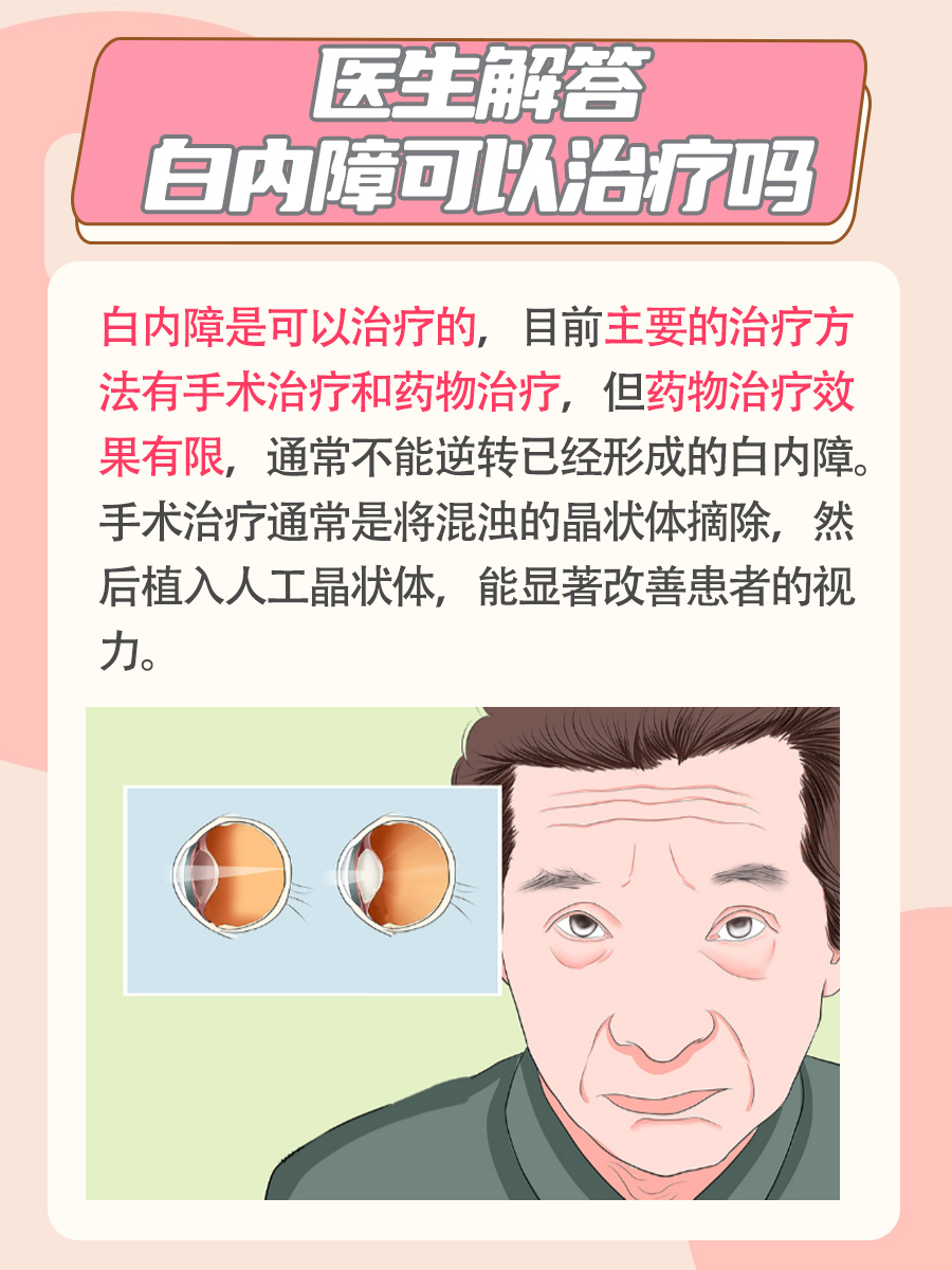 白内障可以治疗吗？一文了解