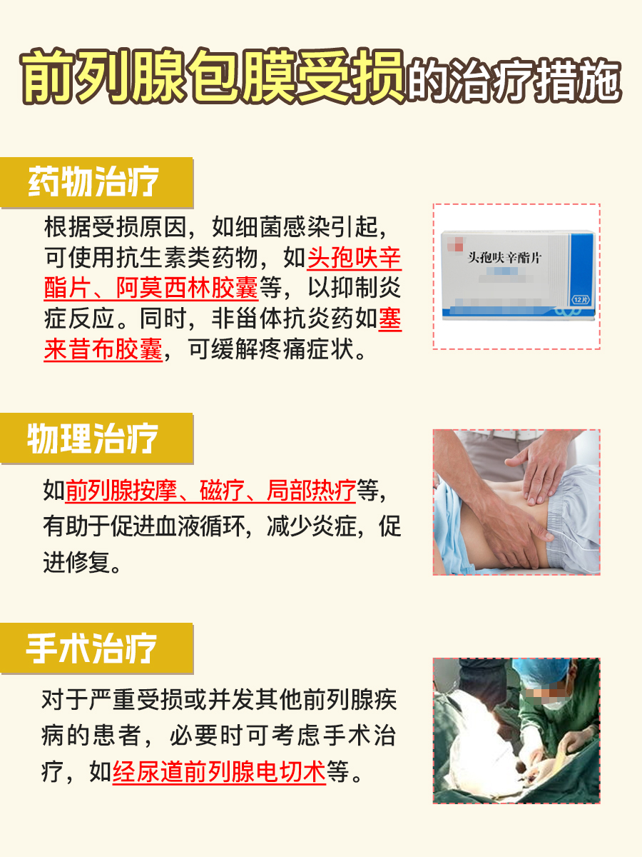 你知道吗?前列腺包膜完整意味着什么?