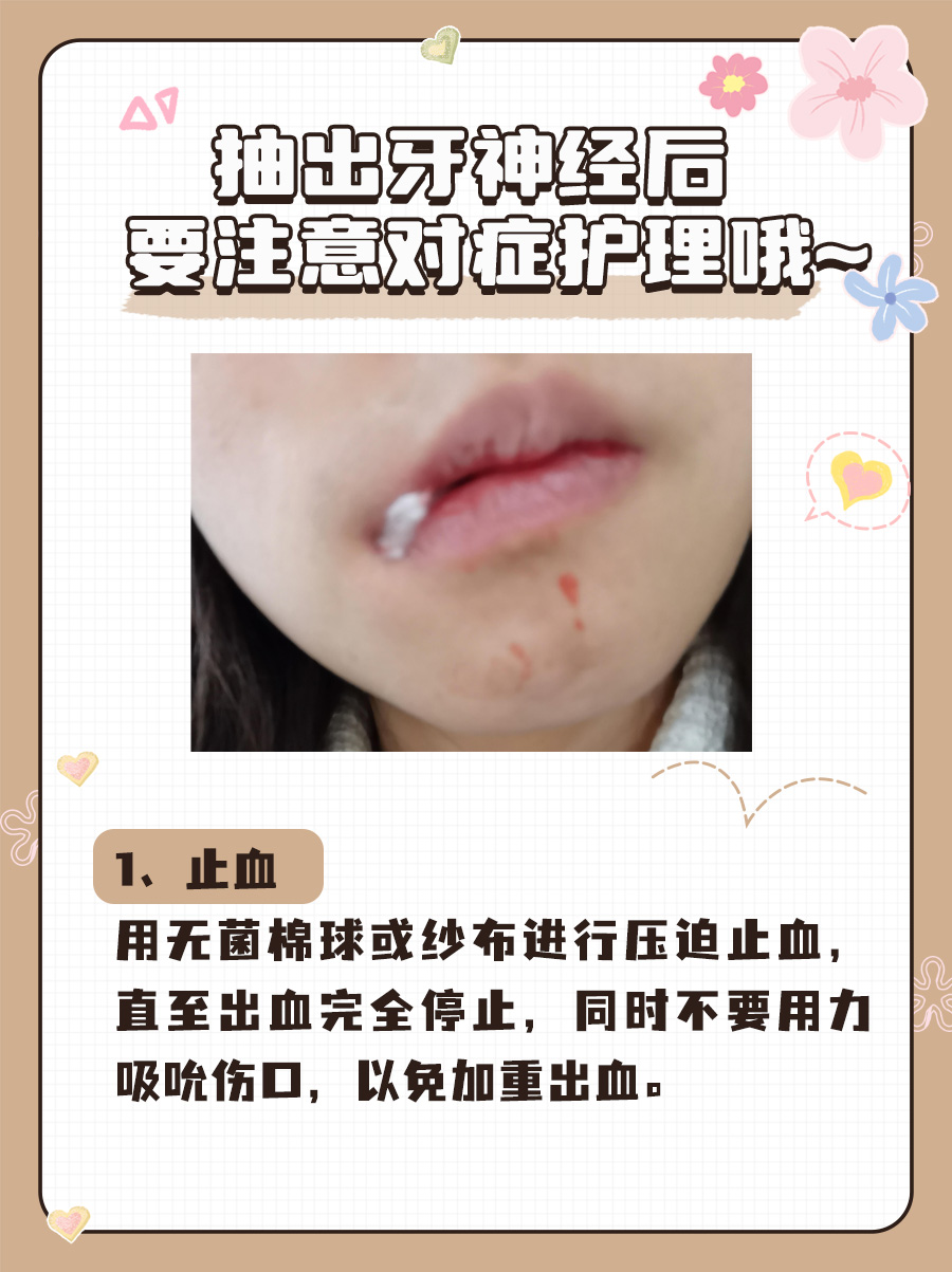 牙神经长啥样？抽出来后怎么护理呢？