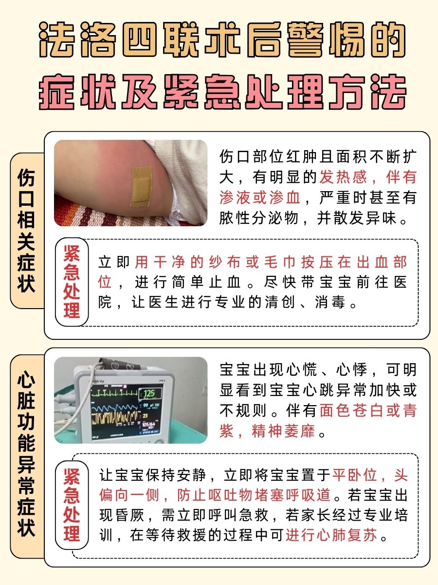 宝宝法洛四联手术后，养护要点速看