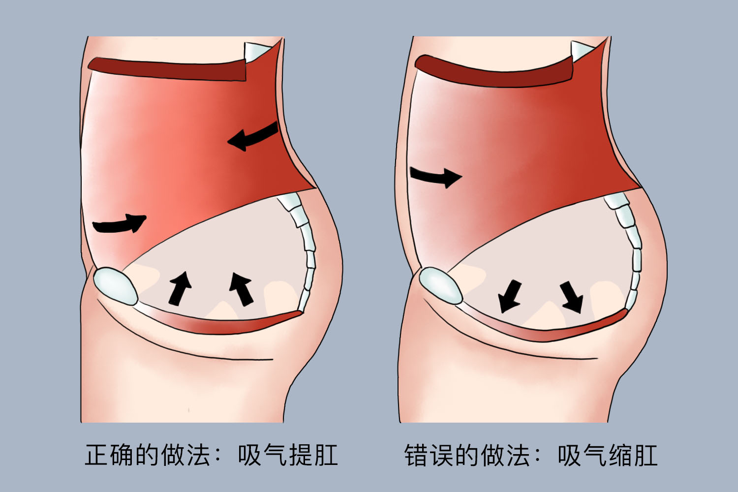 提肛图解图片