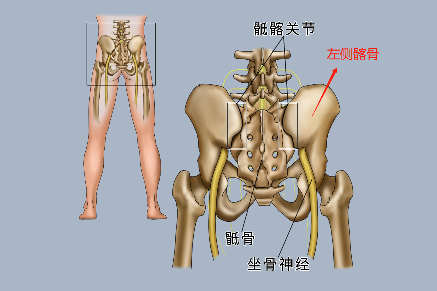 左侧髂骨位置示意图