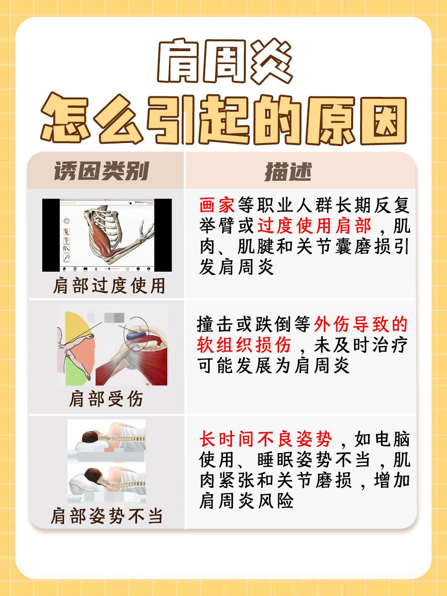肩周炎成因解析:哪些因素导致肩部疼痛