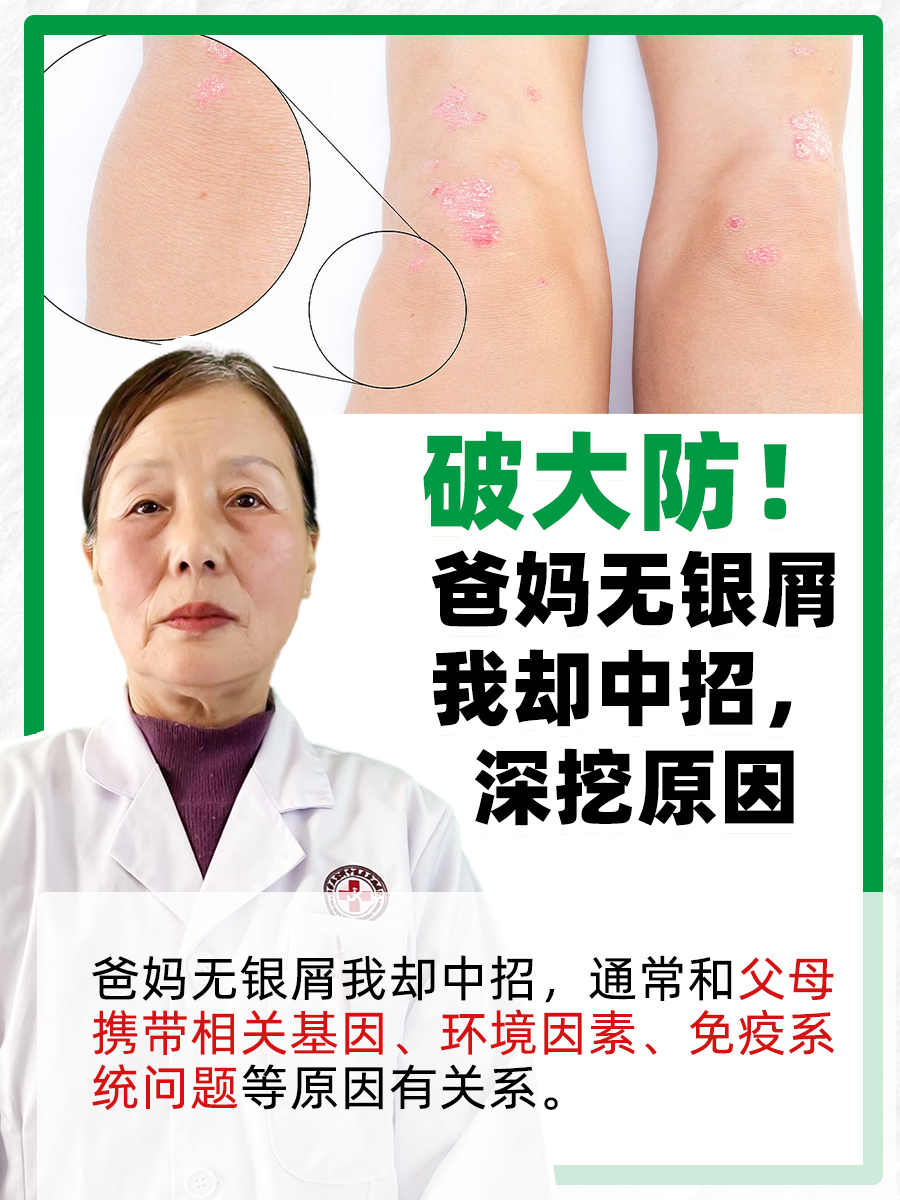 破大防!爸妈无银屑我却中招,深挖原因