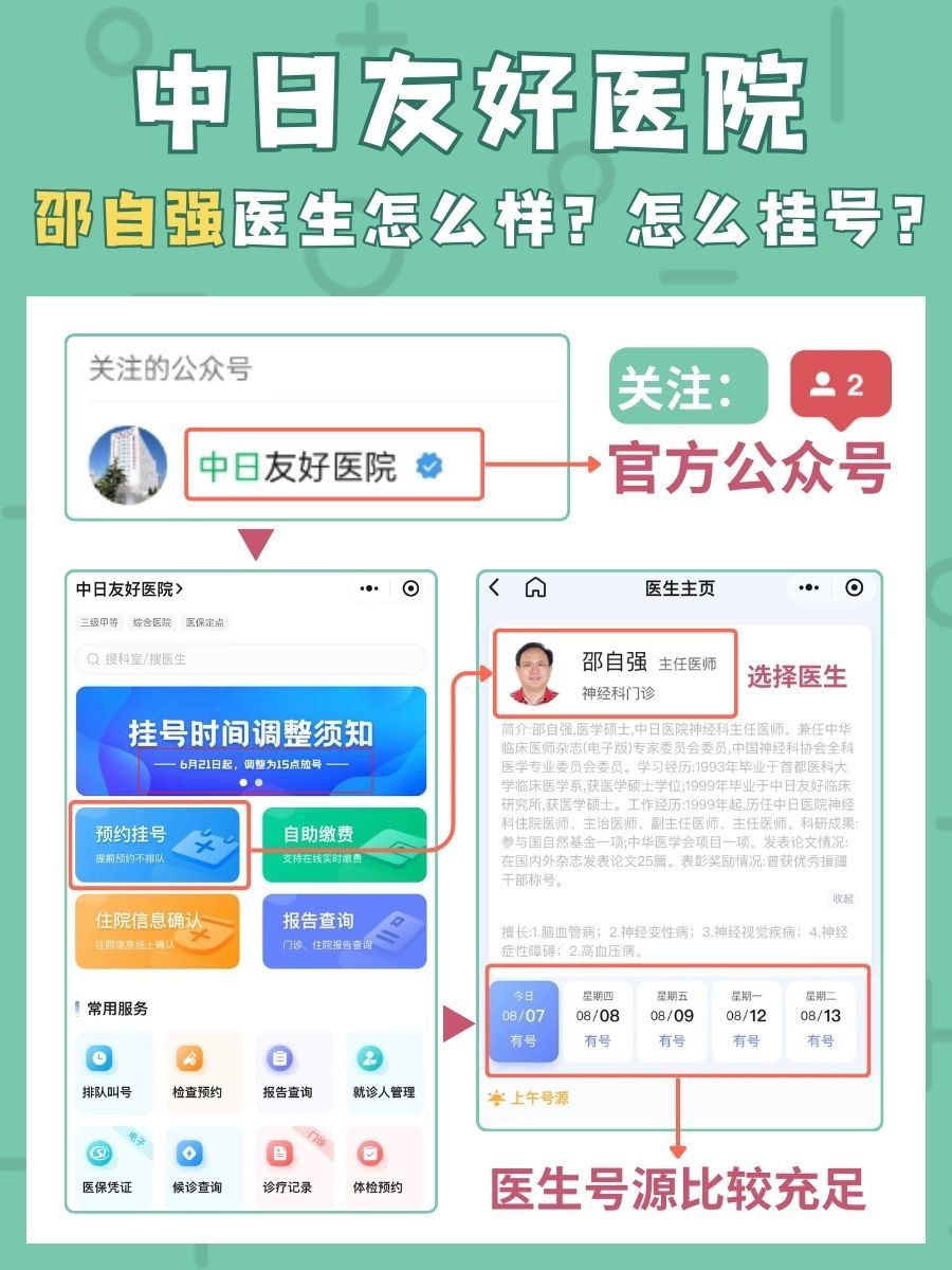 中日友好医院邵自强医生怎么样？怎么挂号？