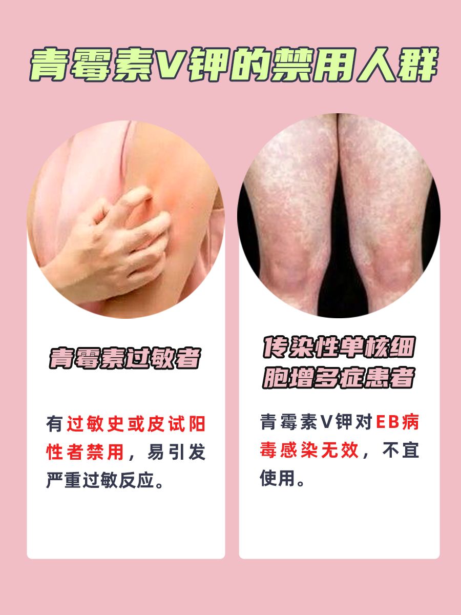梅毒治疗攻略：青霉素V钾的服用疗程