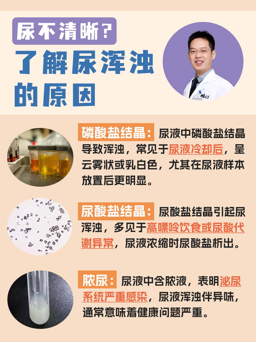尿浑浊背后的秘密：常见原因