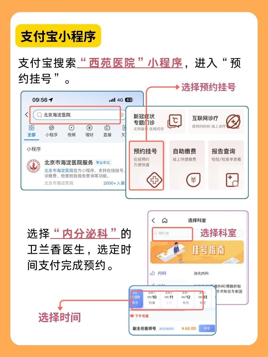 北京西苑医院卫兰香医生怎么样？怎么挂号？