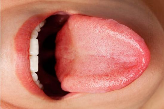 正常舌头形状图 正常舌头形状图