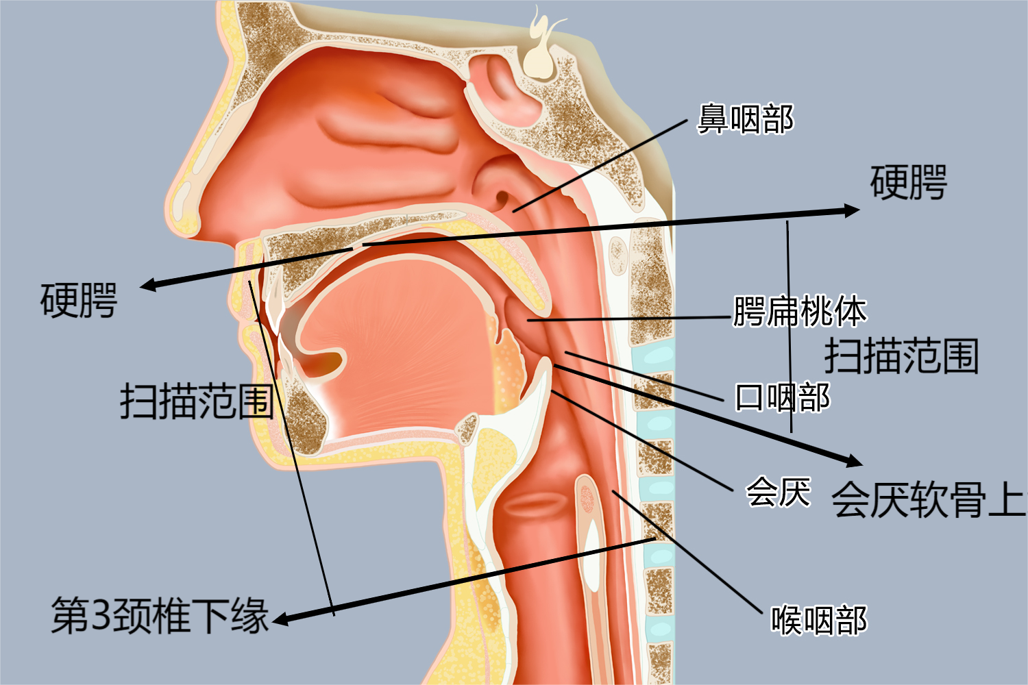 口咽CT横断面扫描范围图