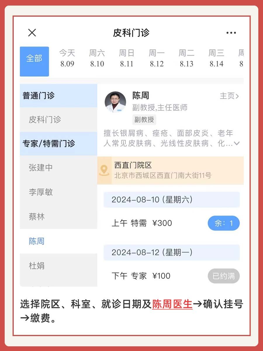 北大人民医院陈周医生怎么样?怎么挂号?
