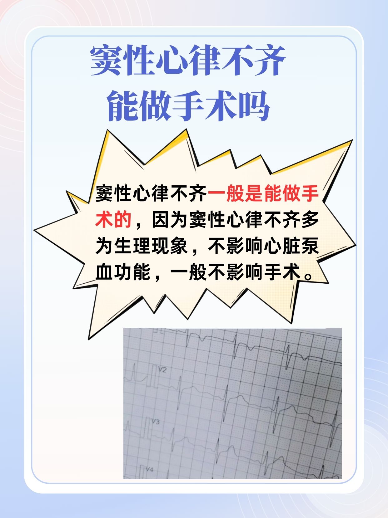 窦性心律不齐能否安全手术？详解与指导