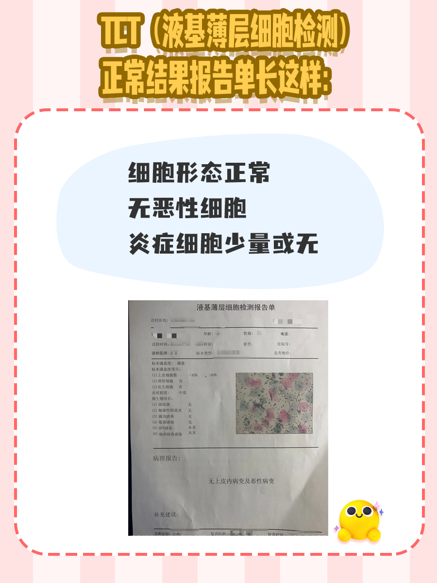 宫颈“密语”解析之正常的TCT报告单长啥样？