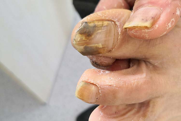 脚部甲板破损图