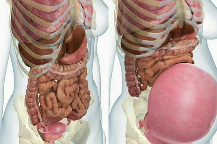 孕晚期内脏挤压图