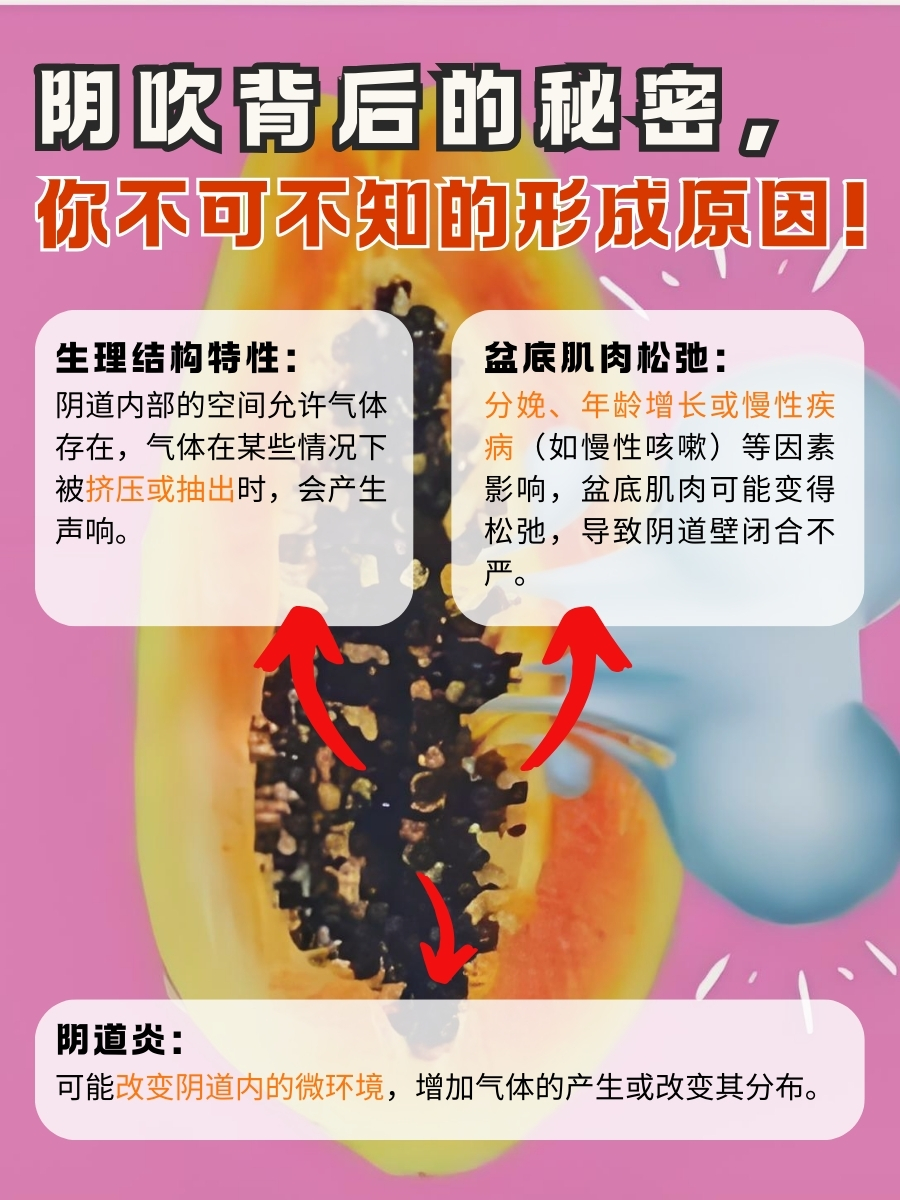 别被阴吹尴尬，了解原因，科学应对不再难！