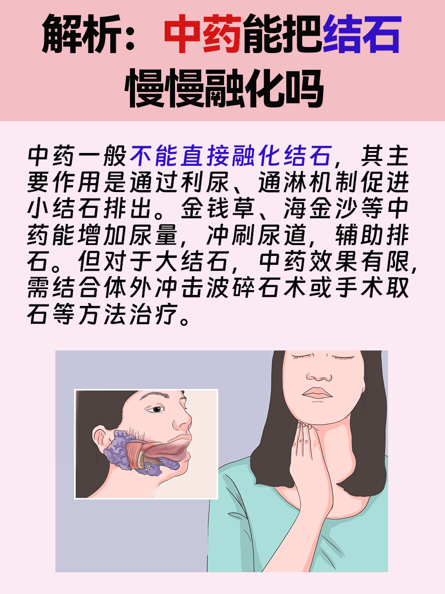 解析：中药能把结石慢慢融化吗