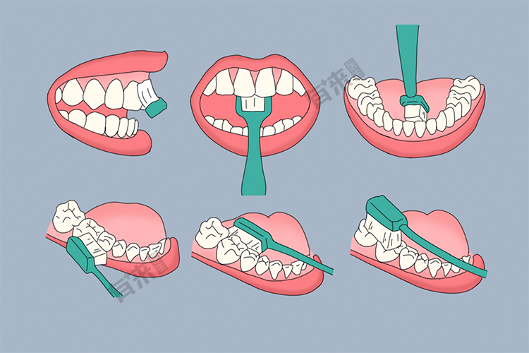 巴氏刷牙法手绘图辅助口腔卫生保健:借助牙线,牙签,牙间刷和end-tuft