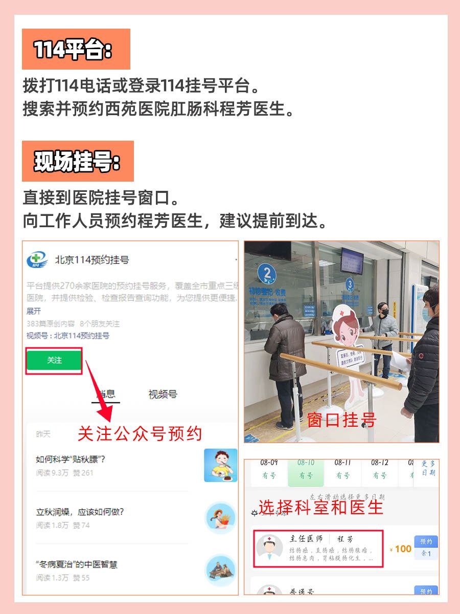 西苑医院程芳医生怎么样？怎么挂号？