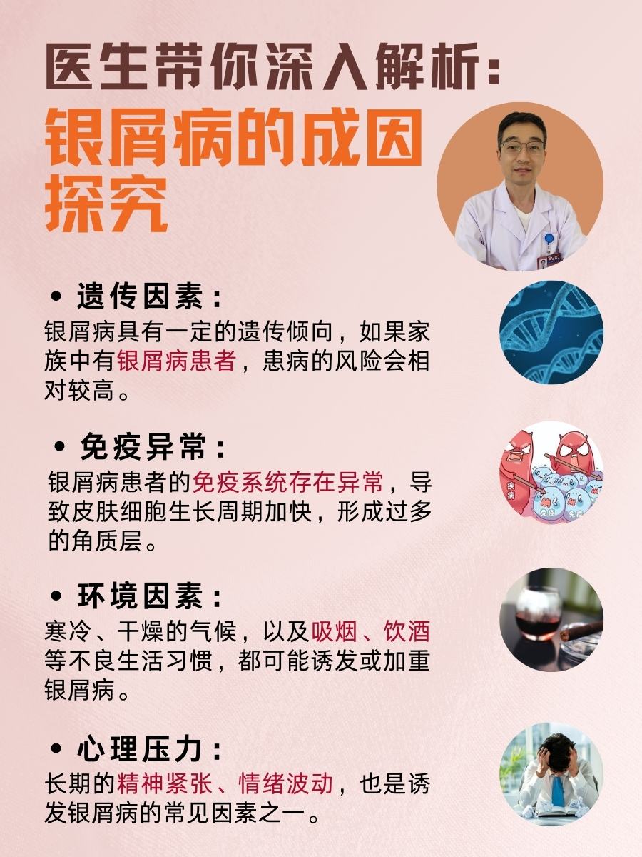 医生带你深入解析：银屑病的成因探究