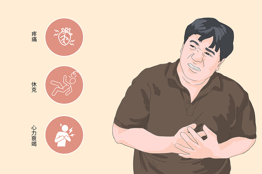 心内膜下心肌梗死图