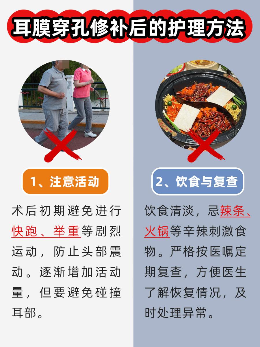 别等了!40多年耳膜穿孔,还能补吗?