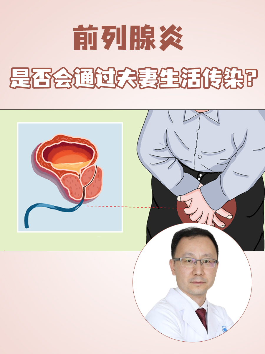 前列腺炎：是否会通过夫妻生活传染？