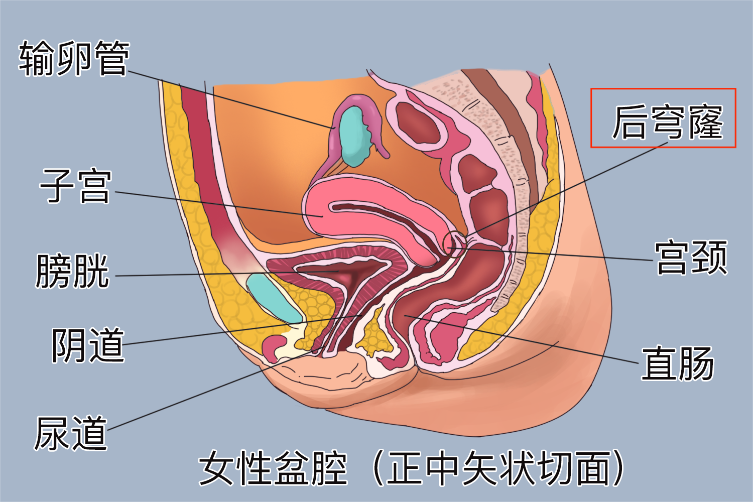 阴道后穹窿图片