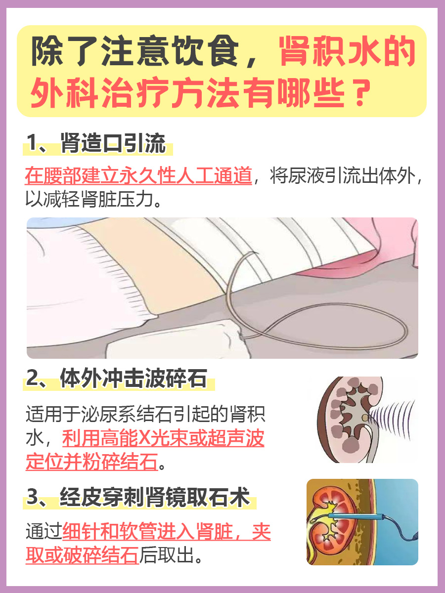 带你了解：肾积水要忌口哪些东西