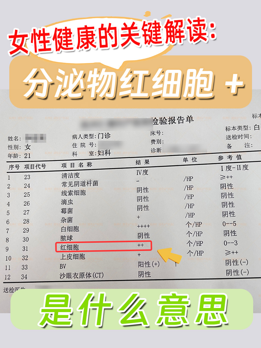 女性健康的关键解读：分泌物红细胞+是什么意思