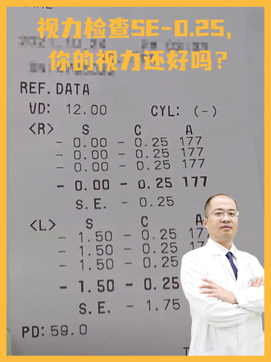 视力检查SE-0.25，你的视力还好吗？