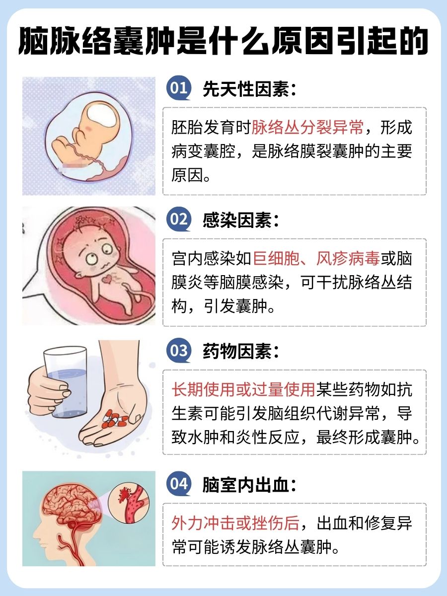 脑脉络囊肿:你不得不知道的发病原因