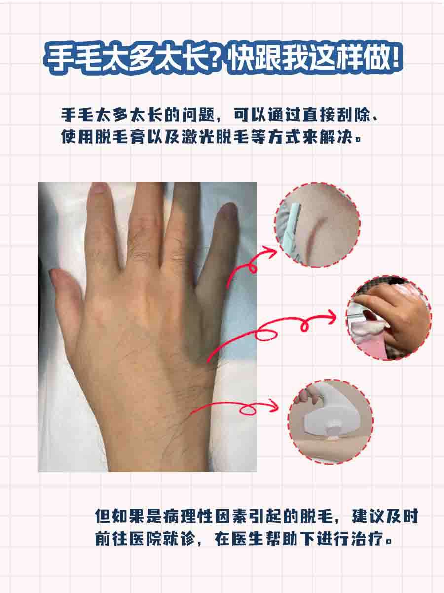 手毛太多太长？快跟我这样做！