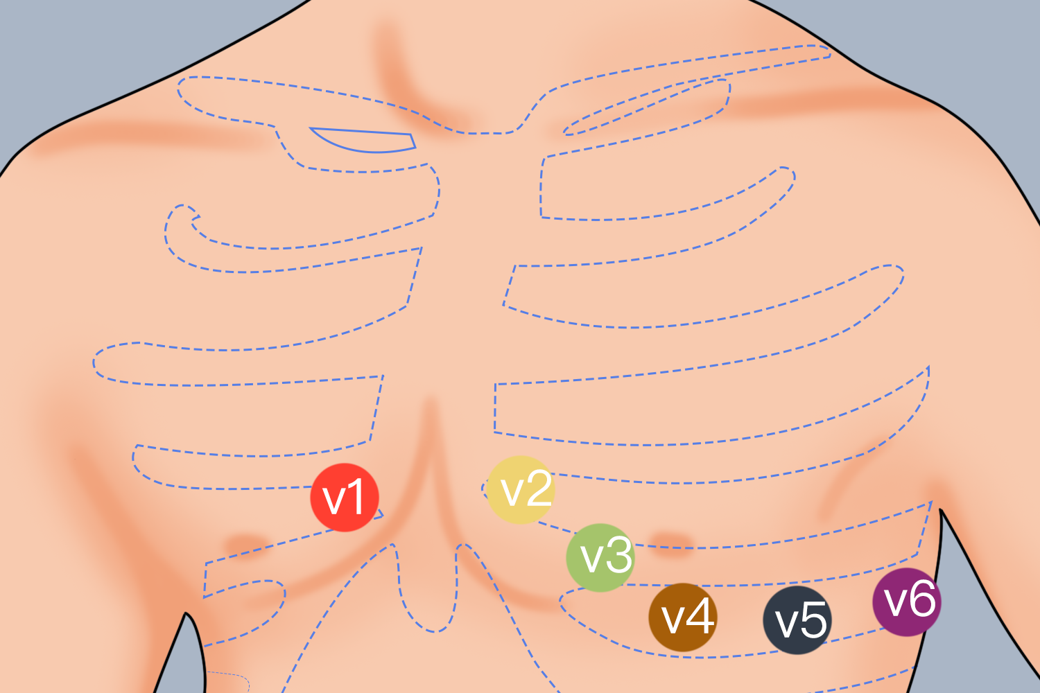 心电图胸导联位置图 心电图胸导联位置图