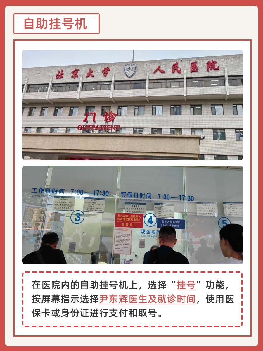 北大人民医院尹东辉医生怎么样?怎么挂号?