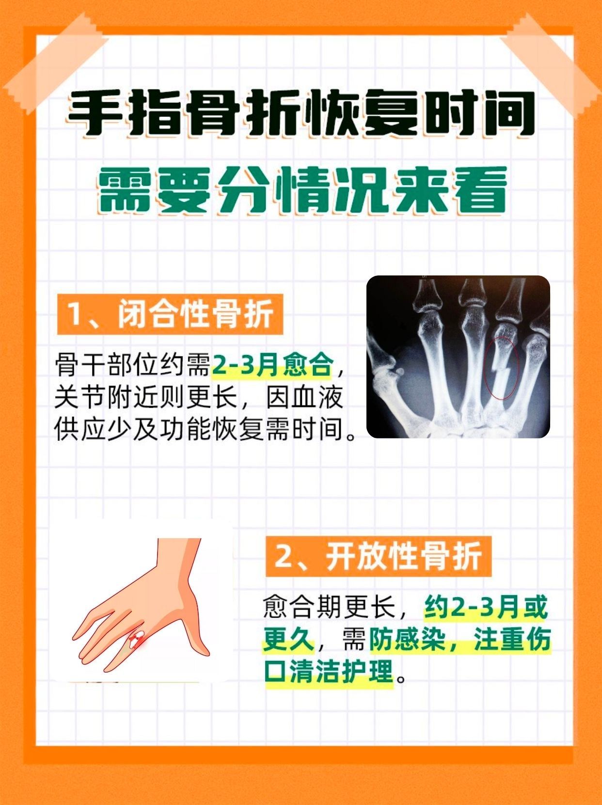 手指骨折要多久才能好,医生解答!