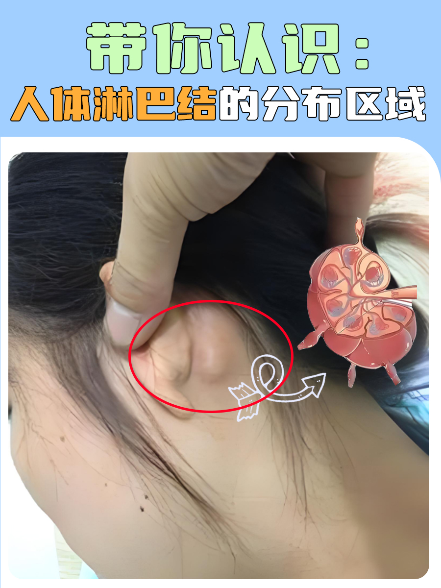 带你认识:人体淋巴结的分布区域