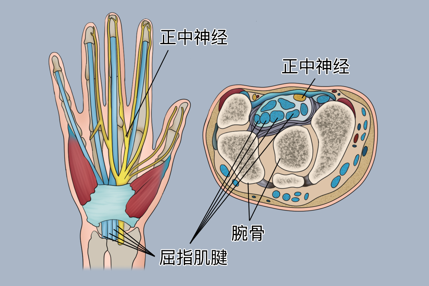手腕正中神经图