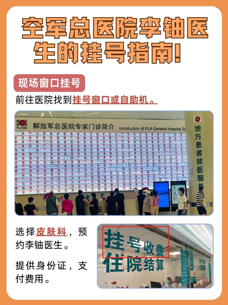 空军总医院李铀医生怎么样？怎么挂号？