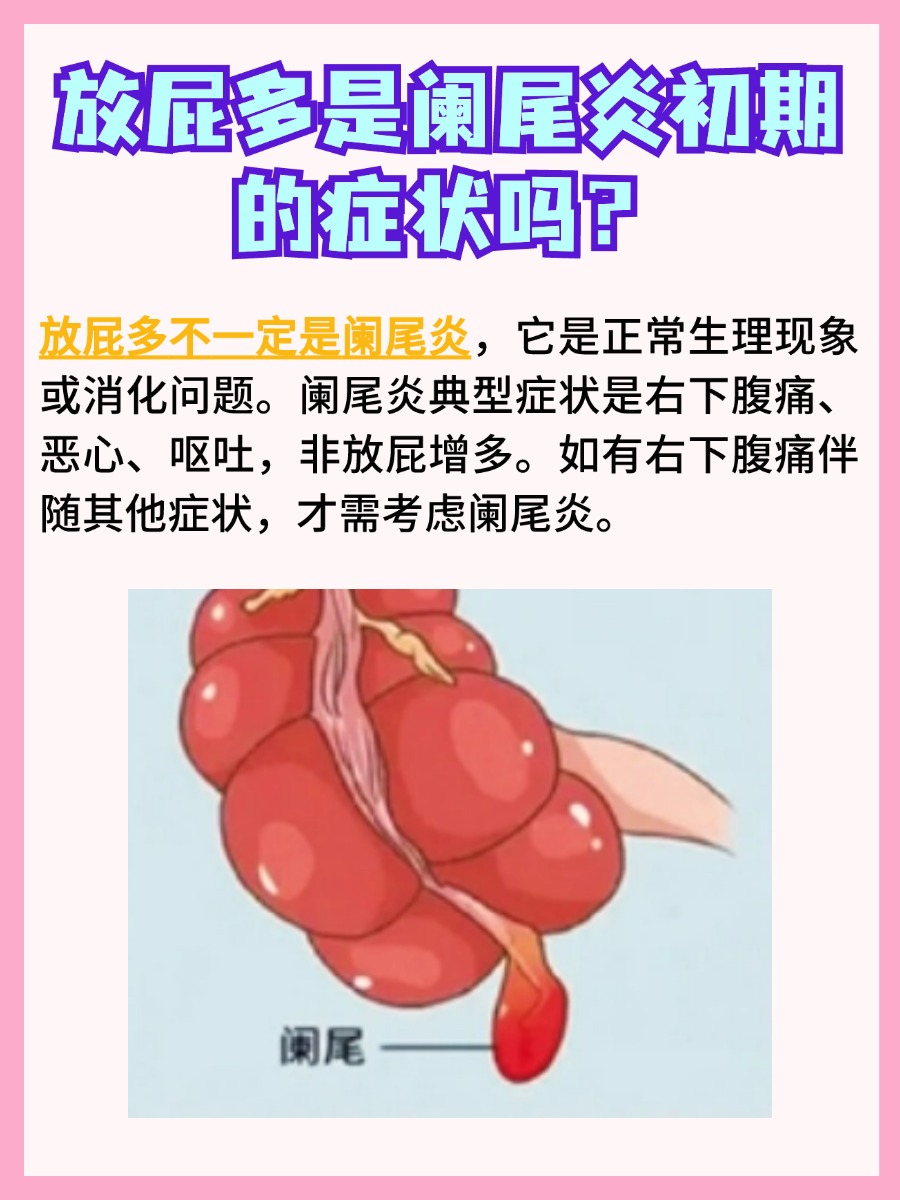 深度解析:放屁多是阑尾炎初期的症状吗?