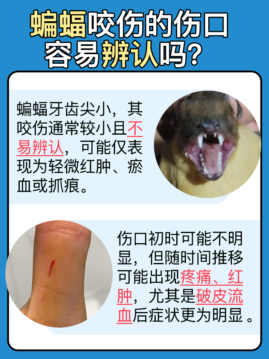 蝙蝠咬伤的伤口特征：你能准确辨认吗？