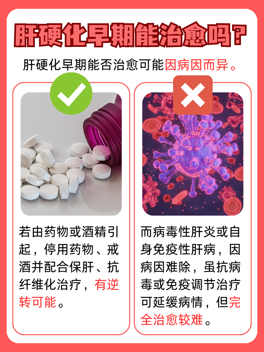 肝硬化早期：治愈之门是否为你敞开？