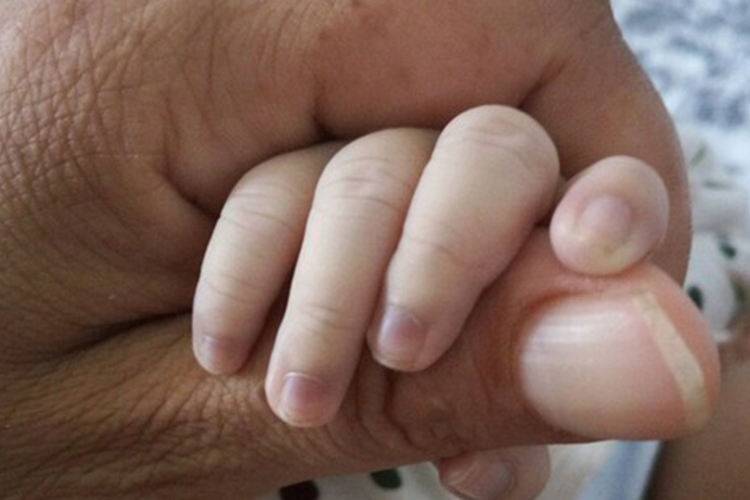 心脏疾病指甲根部发紫图 心脏疾病指甲根部发紫图