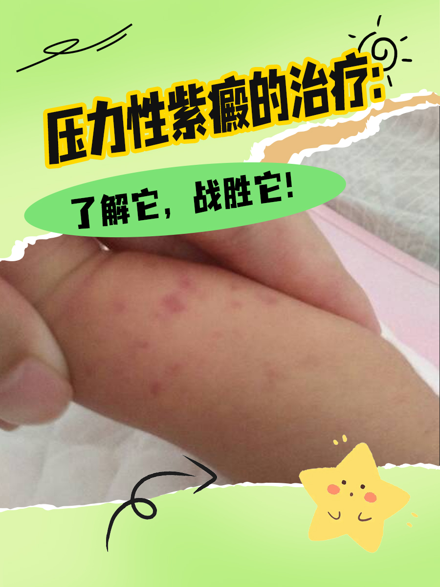 压力性紫癜的治疗:了解它,战胜它!
