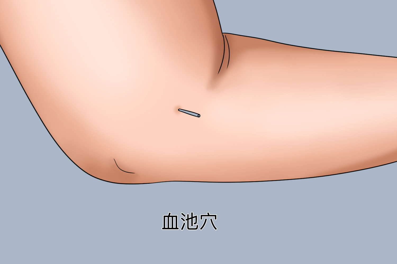 针灸曲池穴图