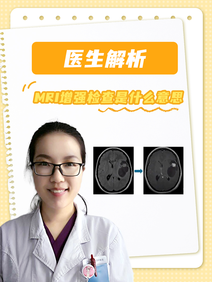 医生解析：MRI增强检查是什么意思