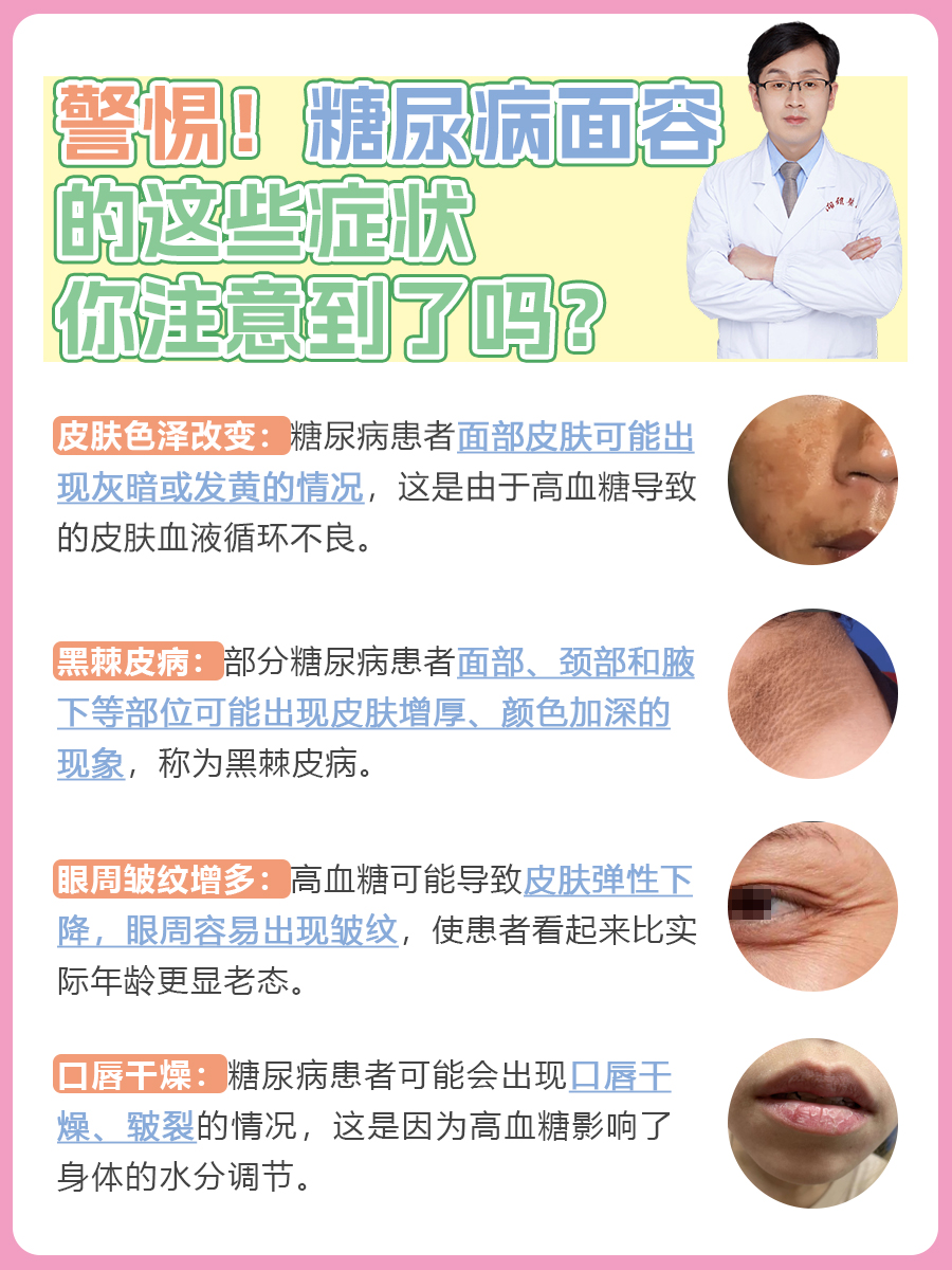 警惕！糖尿病面容的这些症状，你注意到了吗？